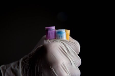 Coronavirus 2019-nCoV Blood Sample. Corona virus outbreaking Epidemic virus Respiratory Syndrome pandemic sample tubeの写真素材