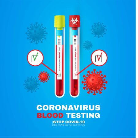 Coronavirus Blood Test. Realistic 3D test tube with blood. 2019-nCoV medical background. Virus Covid 19-NCP. Coronavirus nCoV. Positive and negative testing for COVID.のイラスト素材