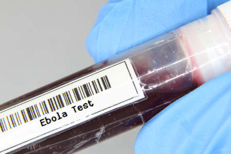 Ebola blood test tube in a medical laboratoryの写真素材
