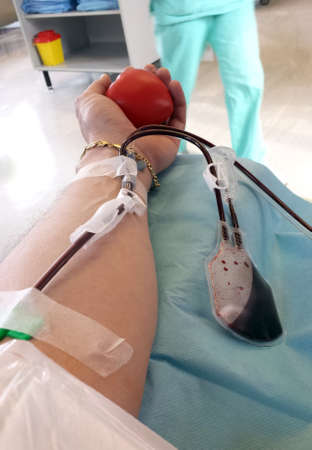 blood donor during the transfusion at the hospital with the needle in the armのeditorial素材