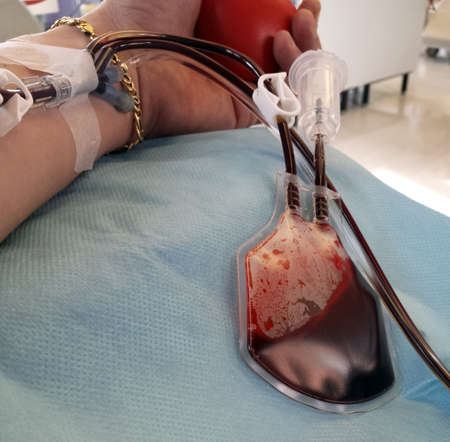 man's arm during the blood transfusion at the hospital with the needle in the armの写真素材