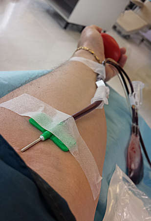 blood donor during the transfusion at the hospital with the needle in the armの写真素材
