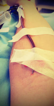 Volunteer Blood donor with surgical needle during transfusion with vintage effectの写真素材