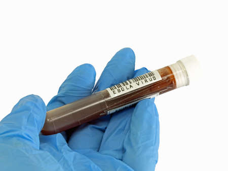 test tube with blood infected with ebola virus text during laboratory analysis in a sterile area in the modern hospital facilityの写真素材