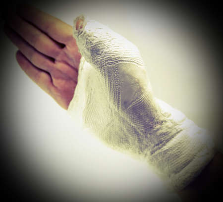 injured person with the broken limb after the car accidentの写真素材