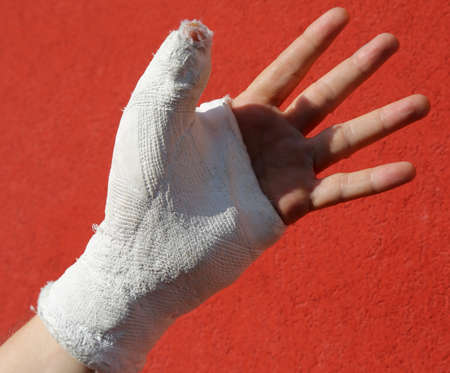 fractured hand with plaster on the red backgroundの写真素材