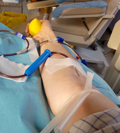 arm of volunteer during the donation blood in the bed of a medical room with tourniquetの写真素材