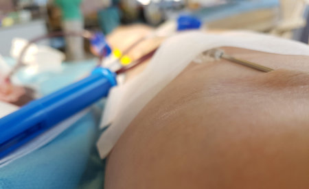 arm of volunteer during the donation blood in the bed of a medical room of an hospital