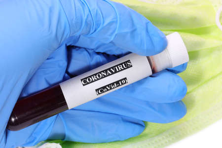 Hand of doctor  with protective glove and test tube with labelの写真素材