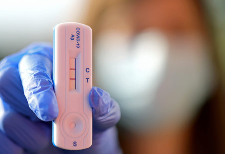 blue latex glove that holds the rapid test with two lines indicating the diagnosis of positivity to...