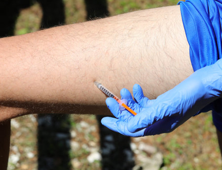 young boy with blue gloves while injecting insulin dose on the thigh of the leg because he has...