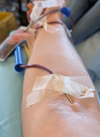 Hospital Healthcare with Patients Arm Undergoing Essential Blood Draw with Needle