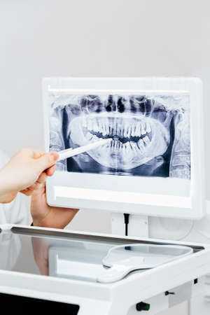 Dentist explaining x ray picture to patientの写真素材