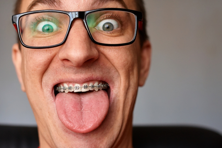 Curved teeth of guy with braces in glasses close up. Portrait of man. Crazy face. Happy expressionの写真素材