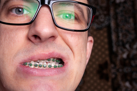 Portrait of a man with crooked teeth and metal braces with green rubber bands close-up. Young man with dental orthodontic braces.の写真素材