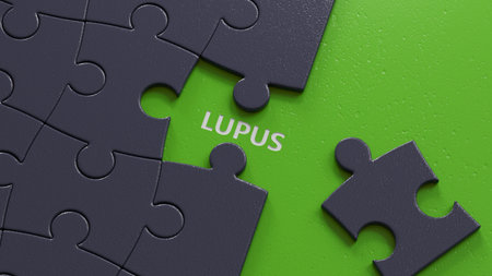 The word LUPUS is written on puzzle pieces with missing pieces. Medical concept.close up of puzzle pieces with missing pieces.3D rendering.の写真素材