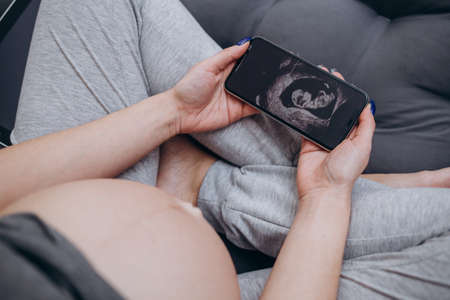 Pregnant woman looking at ultrasound scan of baby, close up of scanの写真素材