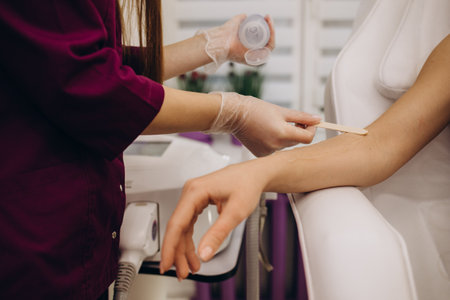 beautician removes hair on beautiful female hands using a laser. hair removal on the hands, laser procedure at clinicの写真素材