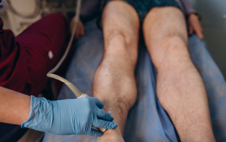 Medical specialist performing doppler ultrasound of the lower limb vesselsの写真素材