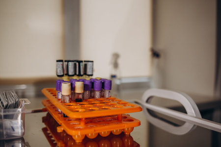 doctor hand taking a blood sample tube from a rack with machines of analysis in the lab background...