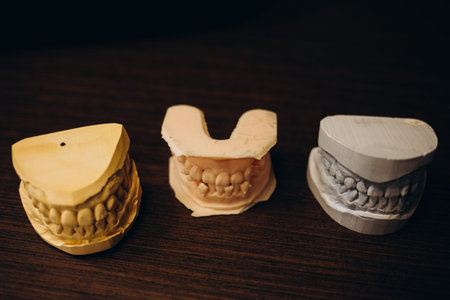 Plaster Cast of jaws. Dental casting gypsum model human Jaws in prosthetic laboratory. Dentistry,...