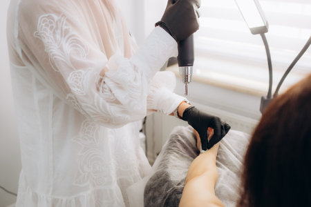 Close-up of laser tattoo removal from woman handの写真素材