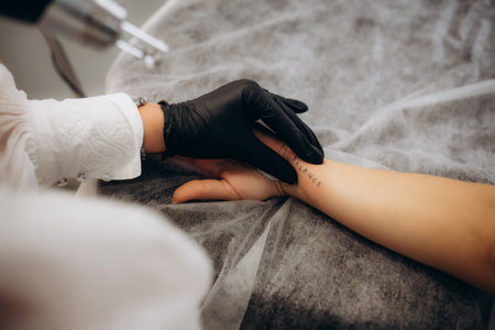 Beautician using laser device to remove an unwanted tattoo from female arm. Concept of erasing...