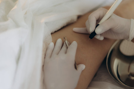Dermatologist doing hair removal treatment on patient's leg with electrolysis. Depilation and beauty...