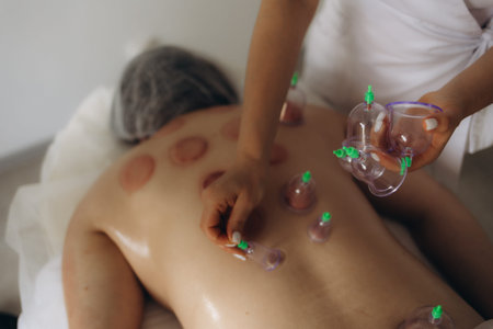 Massage vacuum cups. Close-up of a man lying with cans on his back in a spa. Vacuum jars in...