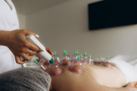 Cupping therapy. Closeup view of woman with glass cups on her back indoorsの写真素材