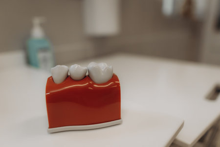 Close-up view of a teeth model resting on a dentist's desk, highlighting the importance of healthy gums and strong teeth in oral careの写真素材