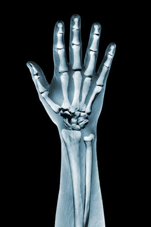 x-ray hand on black backgroundの写真素材
