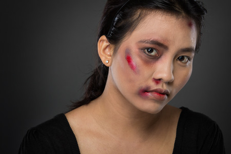 portrait of a asian woman victim of domestic abuseの写真素材