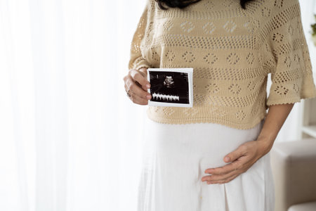 asian pregnant woman holding ultrasound scan when standingの写真素材