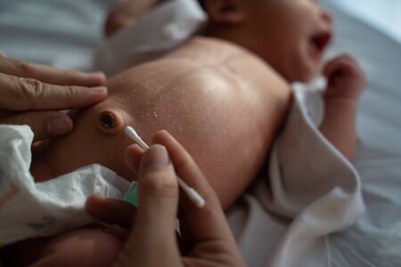 Cleaning navel using cotton budの写真素材