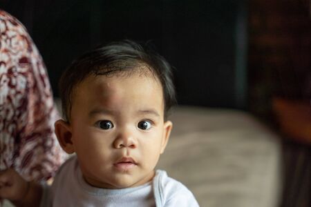 baby with swollen forehead after falling from bedの写真素材