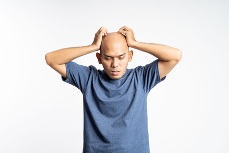 depressed bald man holding his bald head on isolated background