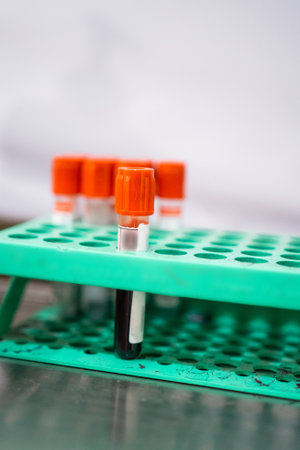 several bottles of blood ampoules on a plastic shelf in the blood transfusion roomの写真素材