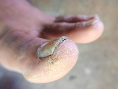 wound on the foot of a man, closeup of photo