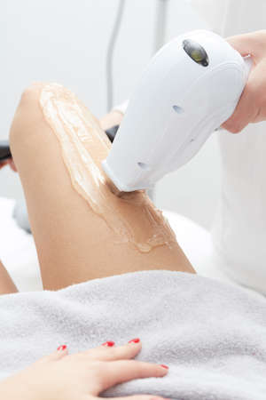 female beautician using laser machine on customer's leg at salonの写真素材