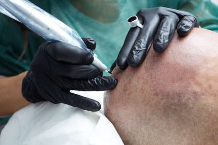 Tricopigmentation - professional tattooist making permanent make up on man's skin headの写真素材