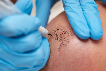 professional tattooist making permanent make up tricopigmentationの写真素材