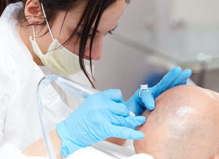 professional tattooist making permanent make up tricopigmentationの写真素材