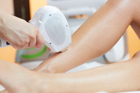 woman at cosmetics salon, legs laser epilationの写真素材
