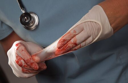 Abstract of Doctors Bloody Surgical Gloves, Scrubs and Stethoscope.の写真素材