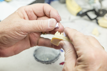 Male Dental Technician Working On A 3D Printed Mold For Tooth Implants In The Lab.の写真素材