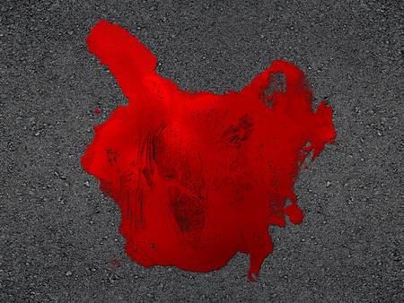Car accident, consequenceの写真素材