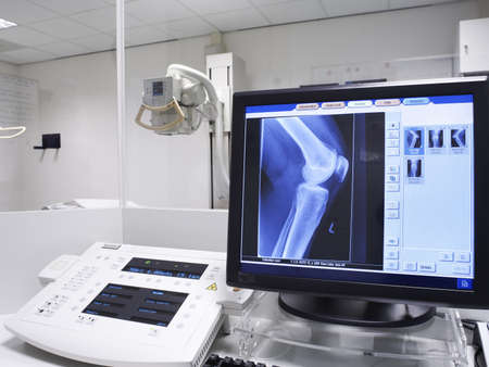 x-ray picture of a knee の写真素材