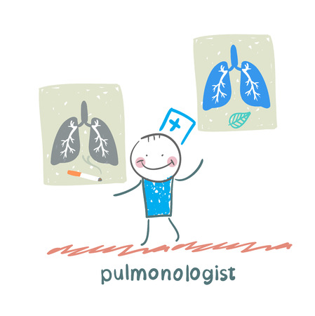 pulmonologist with placards on which painted light smoker and a healthy personのイラスト素材