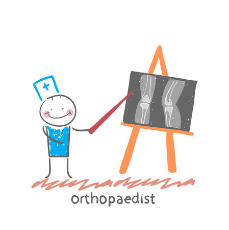 orthopaedist shows an X-rayのイラスト素材